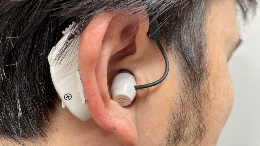 成人（18歳以上）の軽度･中等度難聴の方へ補聴器購入費の一部を助成します